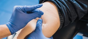 Close-up of a physical therapist performing dry needling on a post-surgical knee with visible scar tissue for pain relief, scar mobility, and trigger point therapy at a physical therapy clinic.