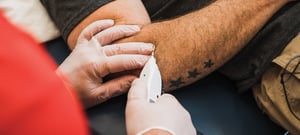 Close-up of a physical therapist performing electrical dry needling on a patient's forearm using an e-stim dry needling device for muscle pain relief and neuromuscular rehabilitation at a physical therapy clinic.
