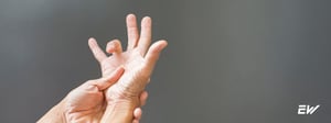 Trigger finger causing finger stiffness and pain, managed through physical therapy and therapeutic exercises.