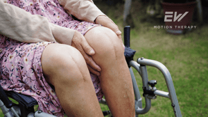 A woman sits in a wheelchair after a double knee replacement.