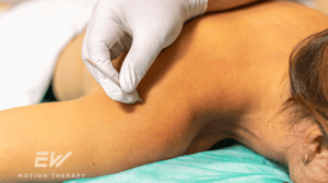 A practitioner wearing gloves inserts a needle into a patient's shoulder.