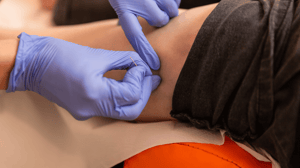 Close-up of a dry needle going in a patient's arm.