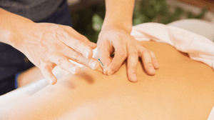 A specialist uses a dry needle on a patient's back.