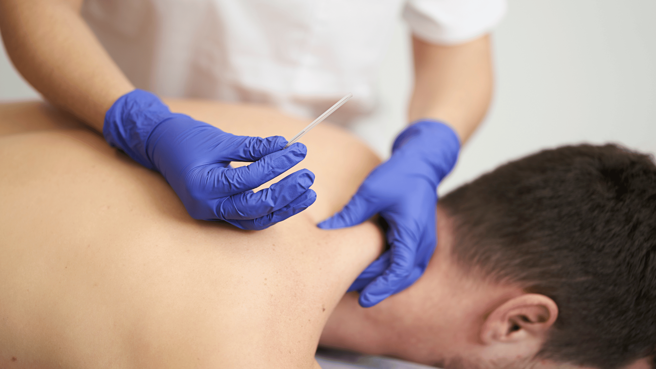 A practitioner does a dry needling treatment on a man's neck.