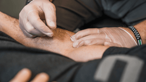 A man puts a dry needle into another man's arm.