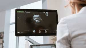 A doctor looks at an ultrasound monitor.