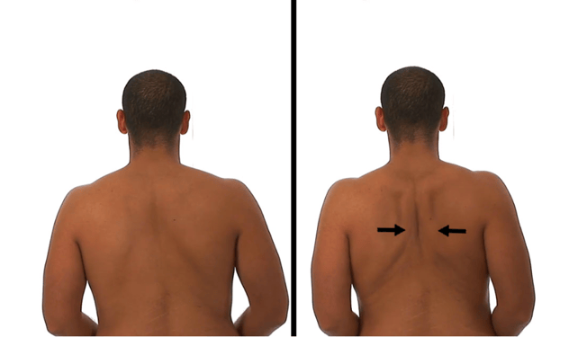 Why Upper Back Stiffness Could Be the Root Cause of Your Shoulder