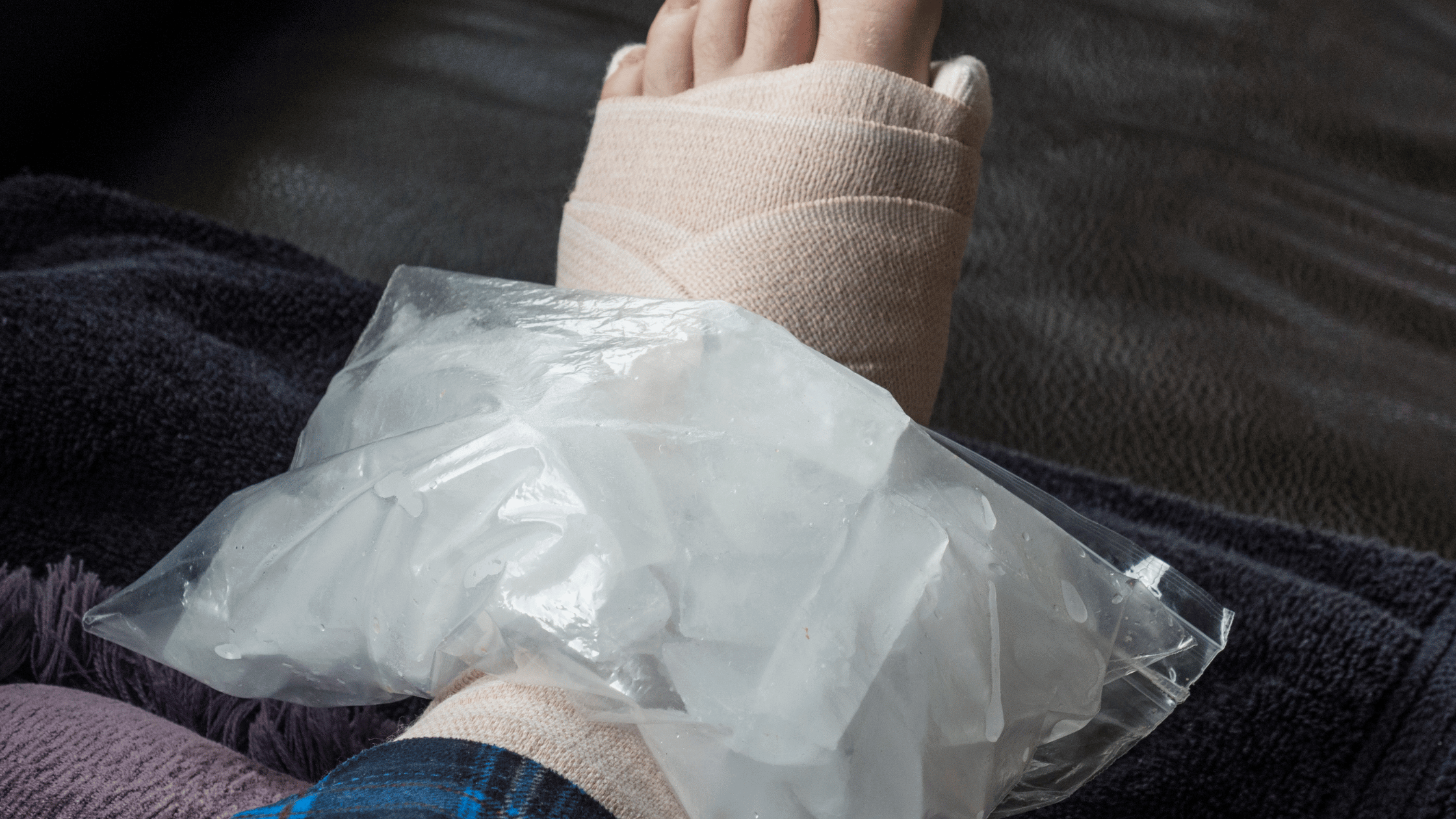 Understanding Ankle Injuries: Causes, Severity, and Treatment Plans