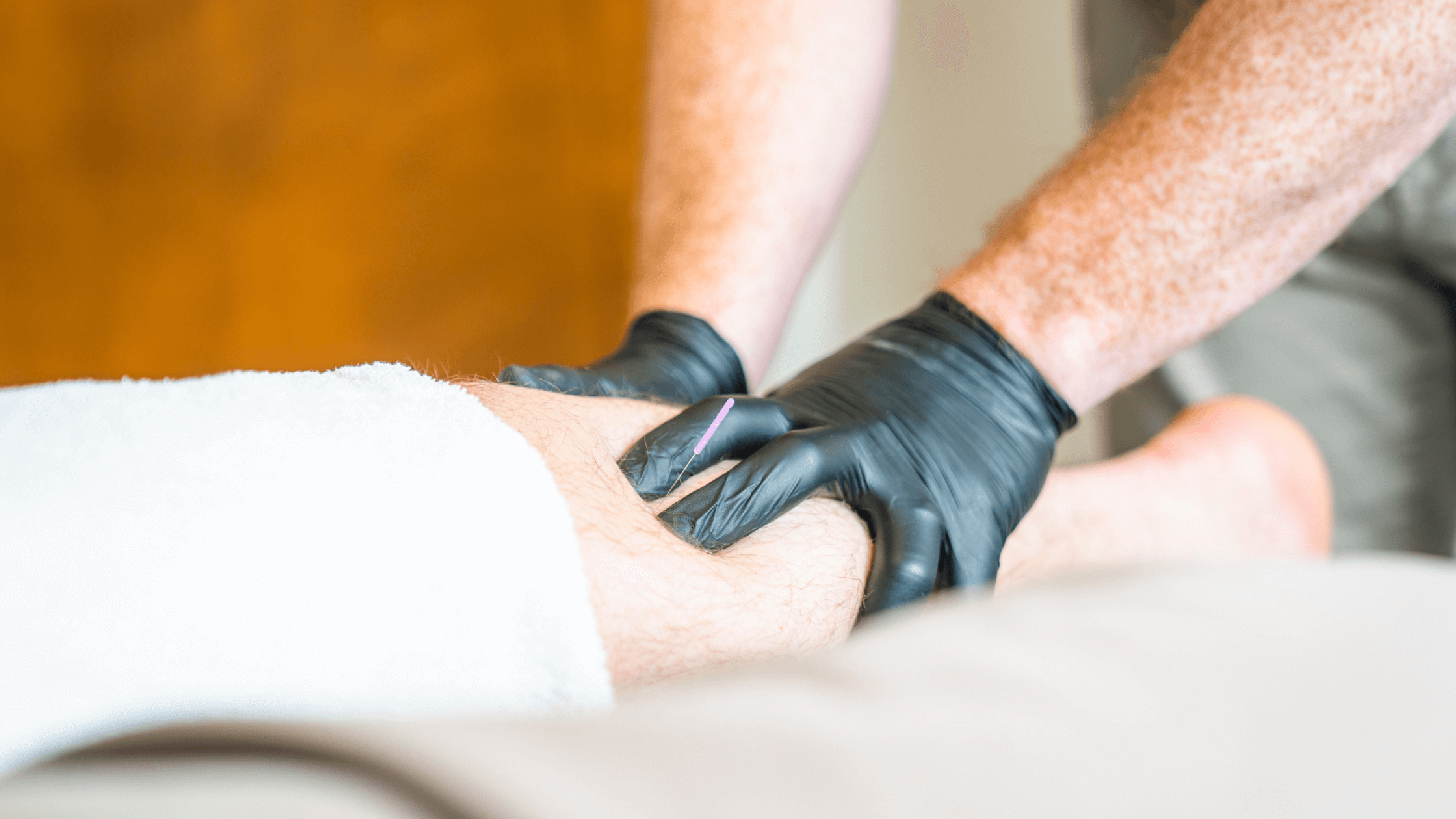 What Is Dry Needling?